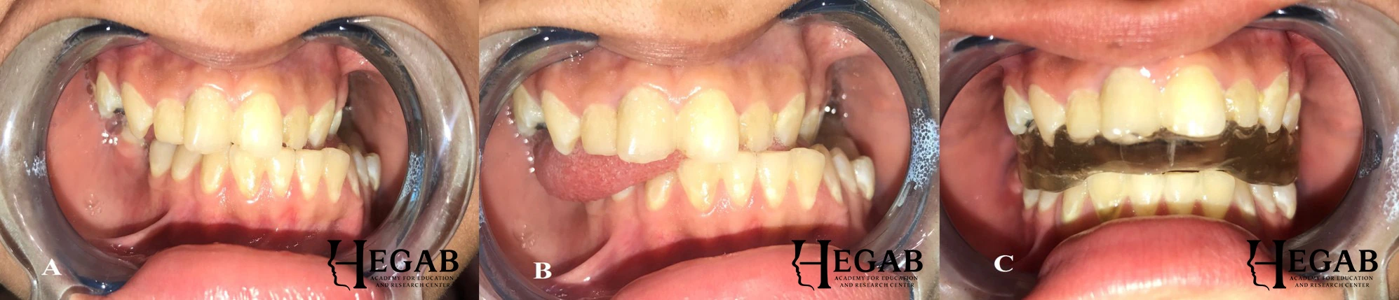 Before treatment