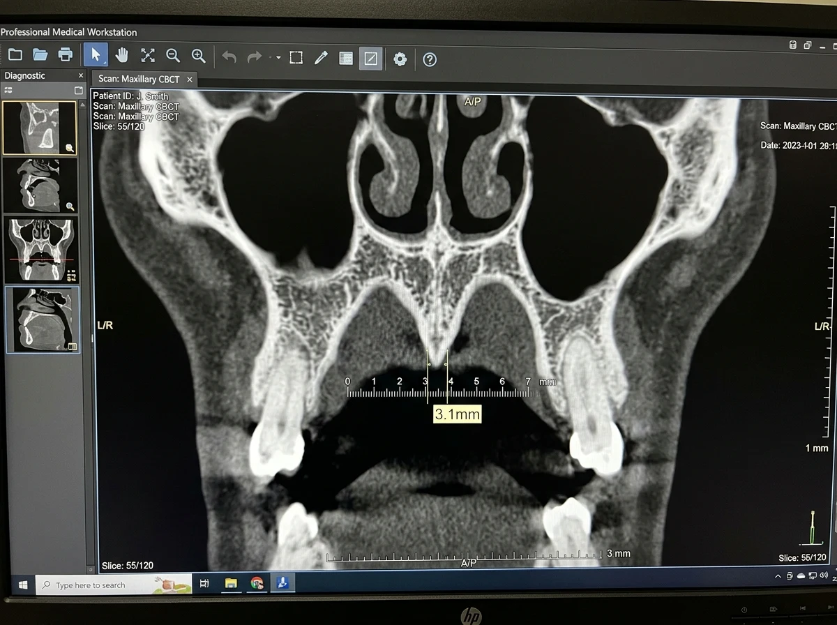 Before treatment