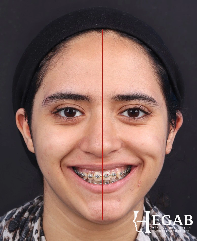 After treatment