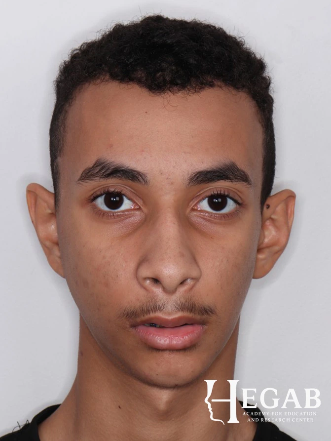 After treatment