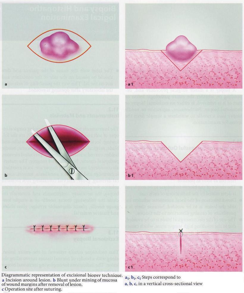 Oral Biopsies1