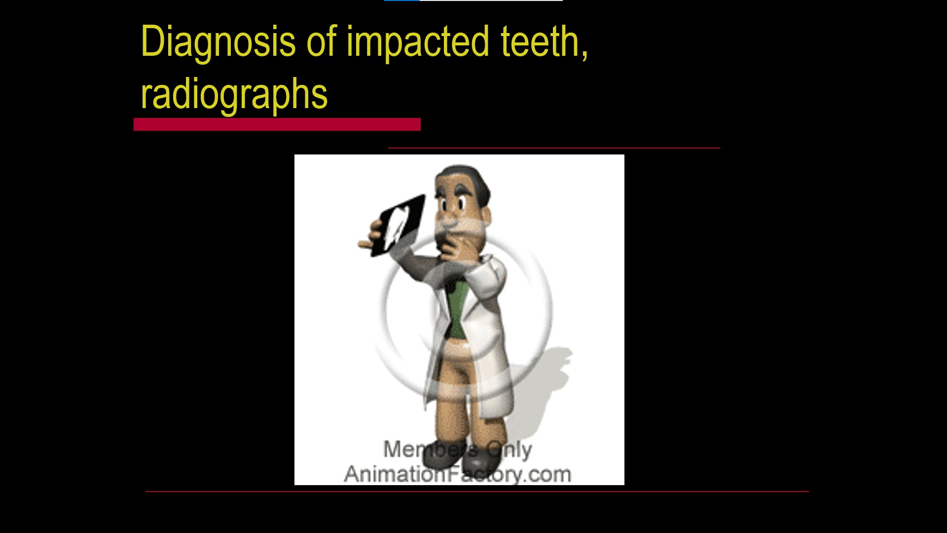 Impacted teeth1