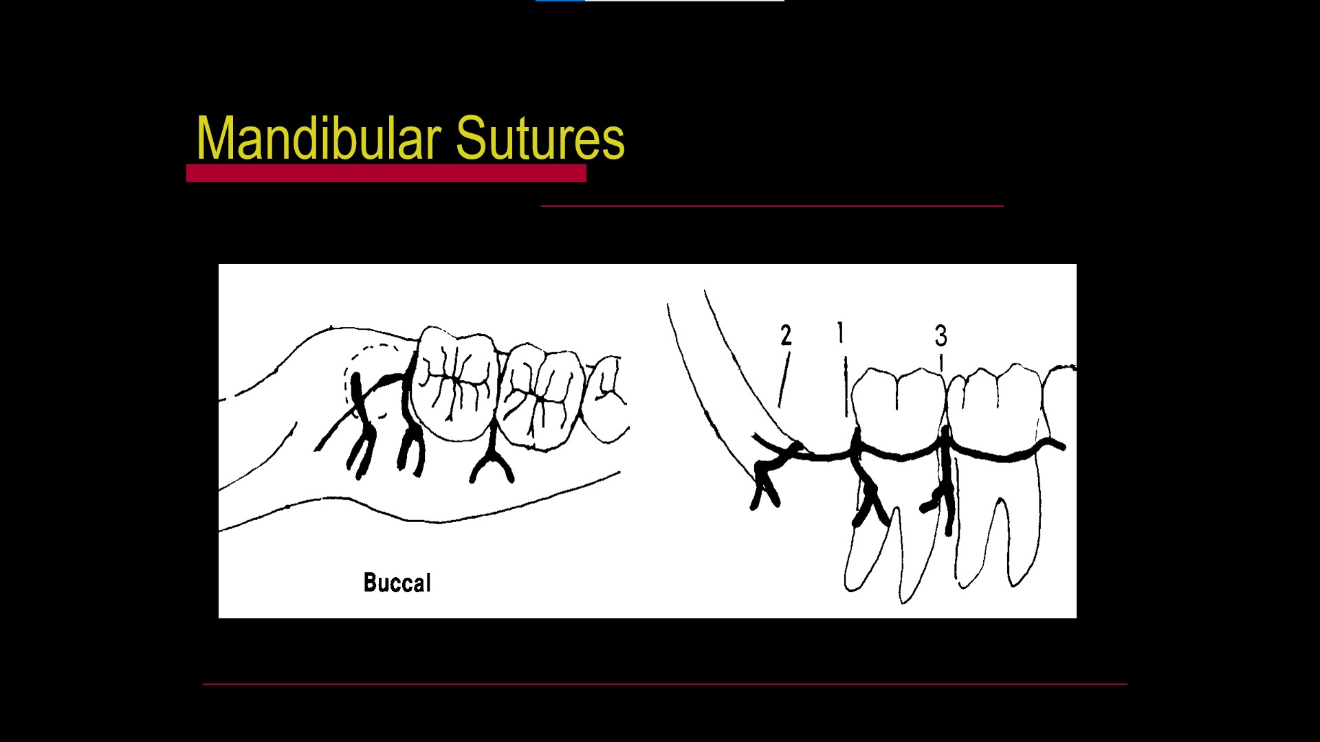 Impacted teeth4